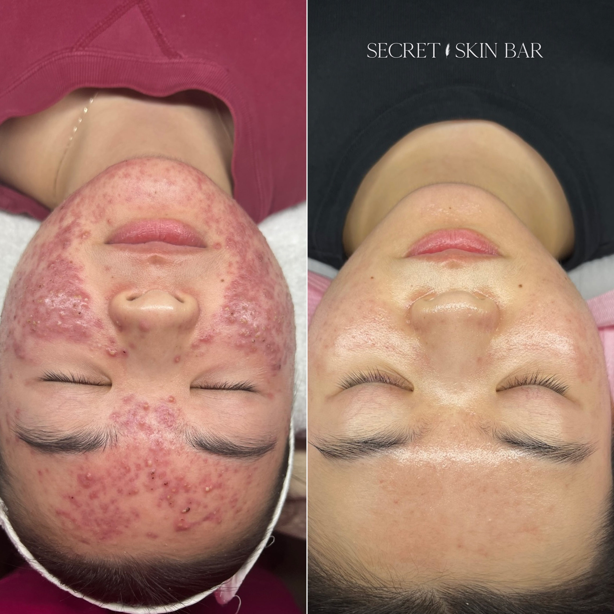 Client skin treatment photo 3