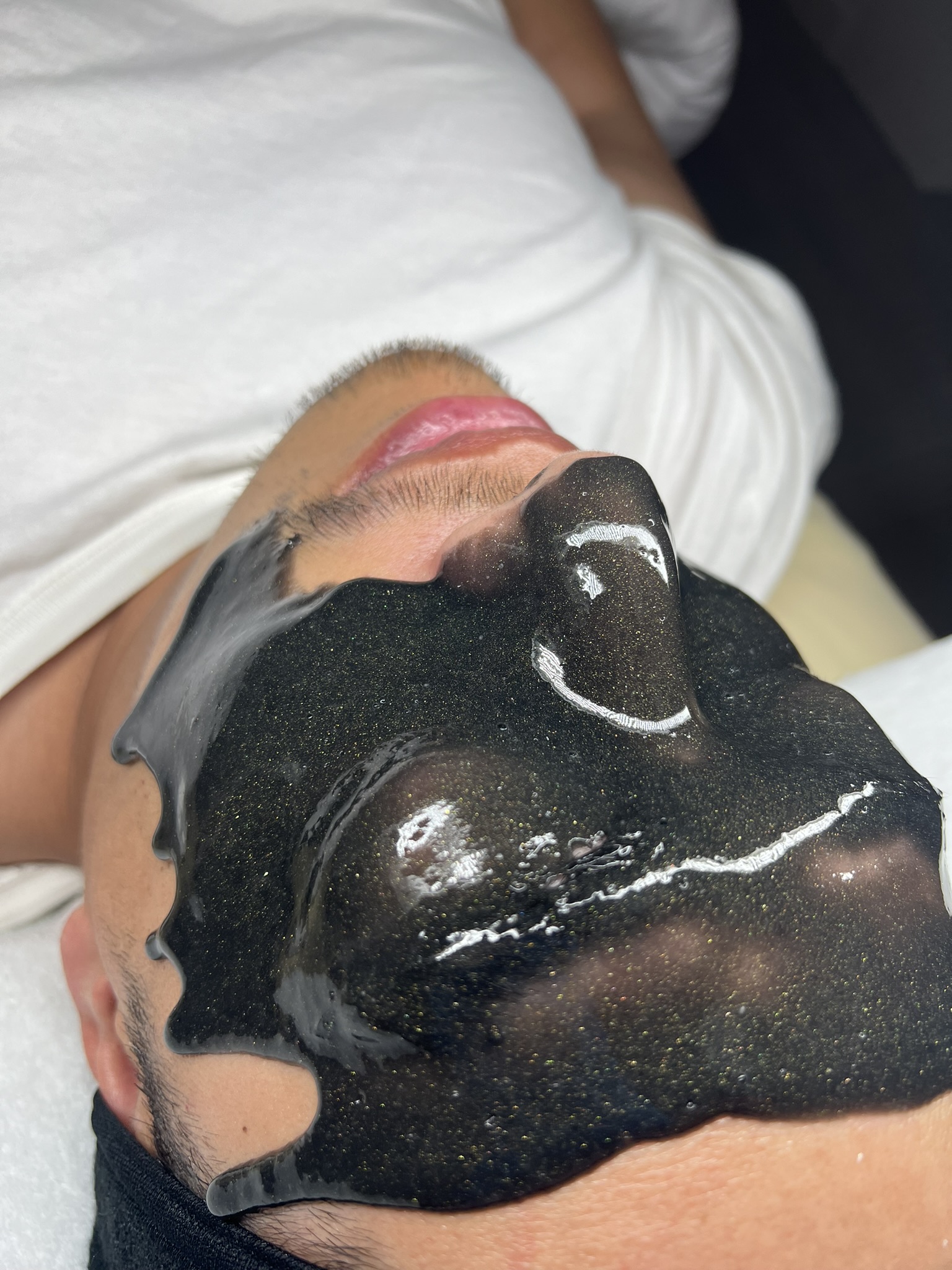 Client skin treatment photo 11