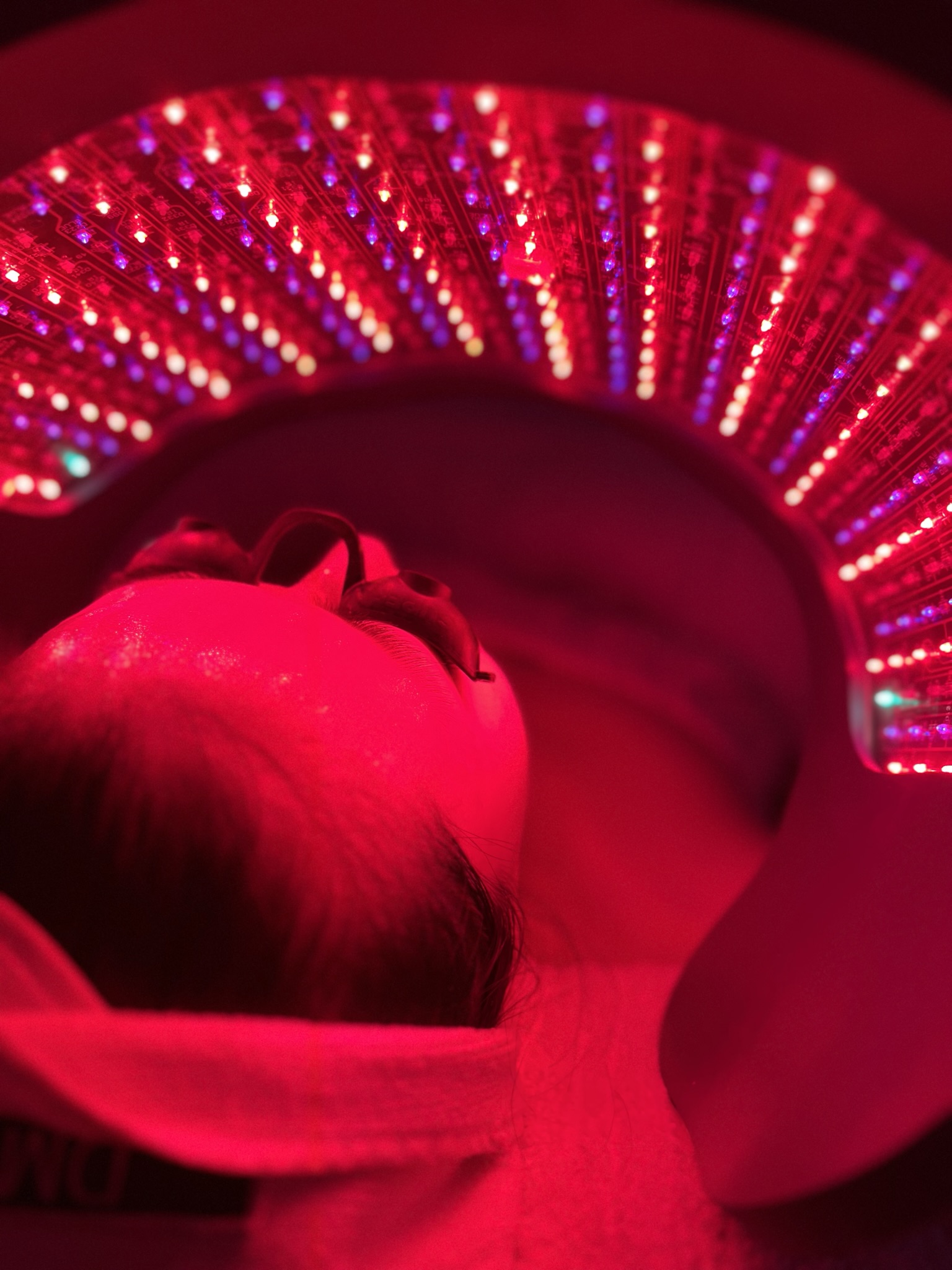 Client treatment photo