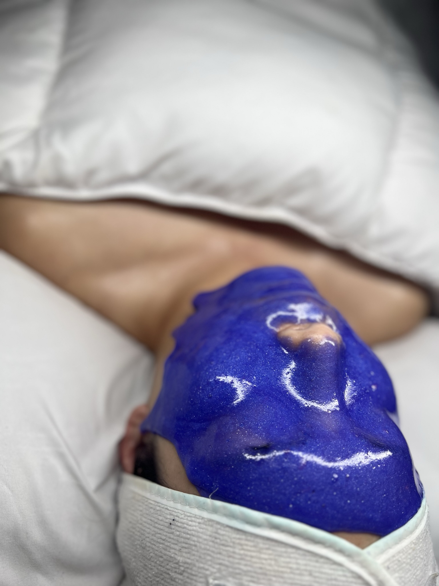 Client skin treatment photo 12