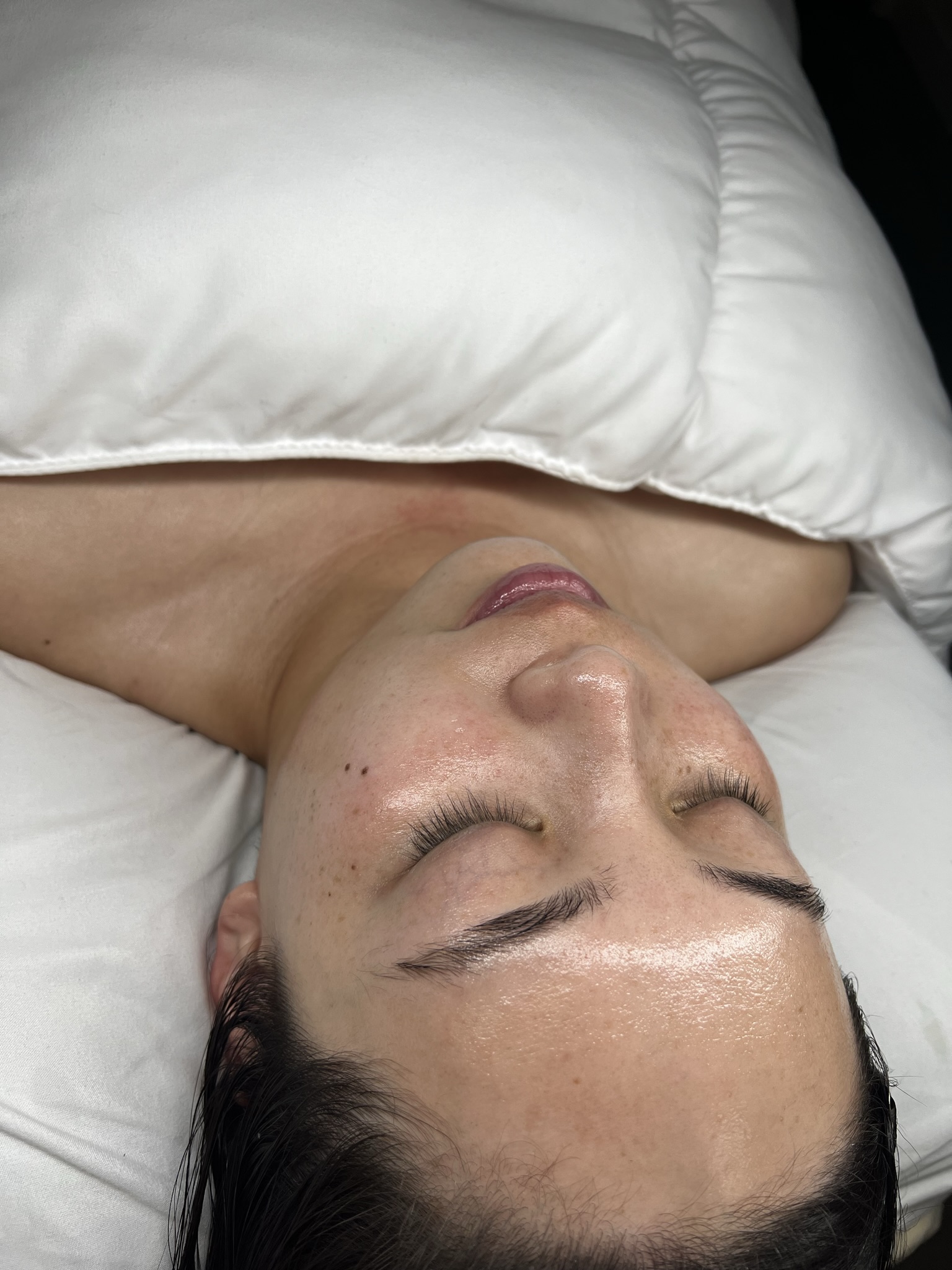 Client skin treatment photo 20