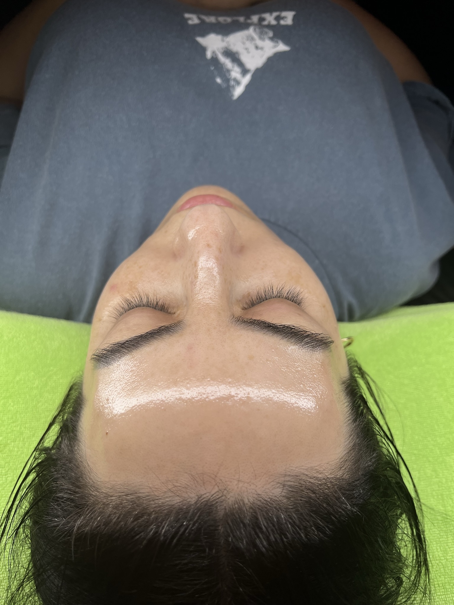 Client skin treatment photo 18